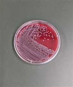 細菌検査2
